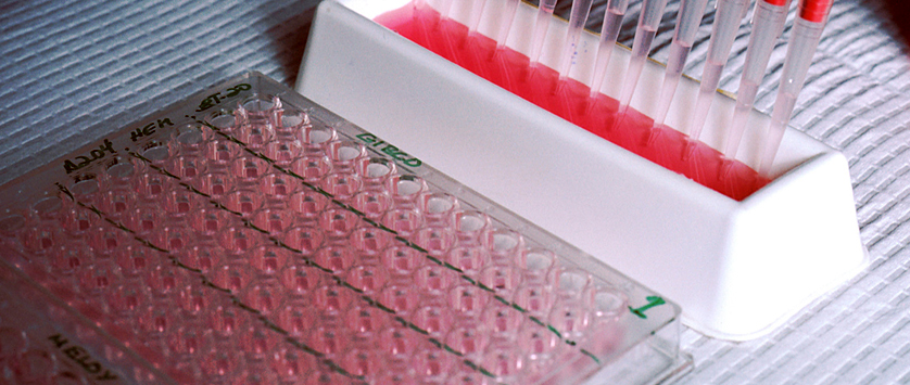 Podsumowanie doniesień z ASH 2014 dotyczące brentuximabu