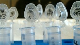 Poszerzona refundacja bendamustyny dla chłoniaków nieziarniczych w świetle danych klinicznych