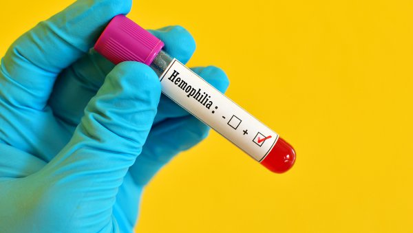 Profilaktyka Emicizumabem w Hemofilii A z Inhibitorem