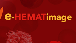 Program edukacyjny e-HEMATimage przeznaczony dla osób wykonujących i interpretujących podstawowe badania hematologiczne
