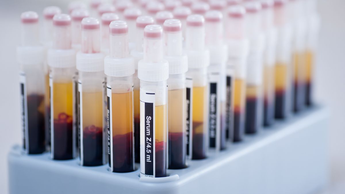 Jakość życia i oszczędność kosztów – marstacimab w profilaktyce hemofilii