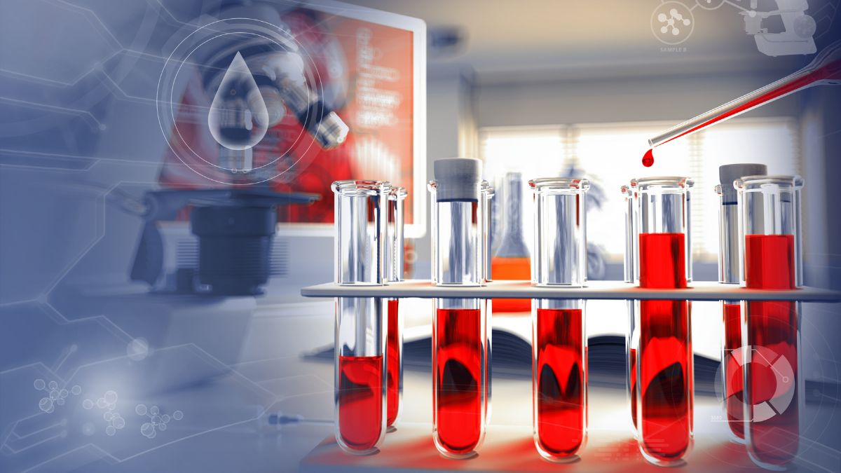 Rekomendacje PTOHD: Nowe podejście do immunotolerancji u dzieci z hemofilią A i...