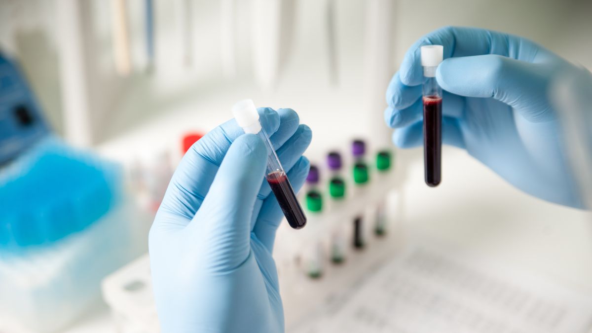 Anemia jako najcięższe powikłanie. Pacjenci i lekarze w Polsce czekają na nowy lek