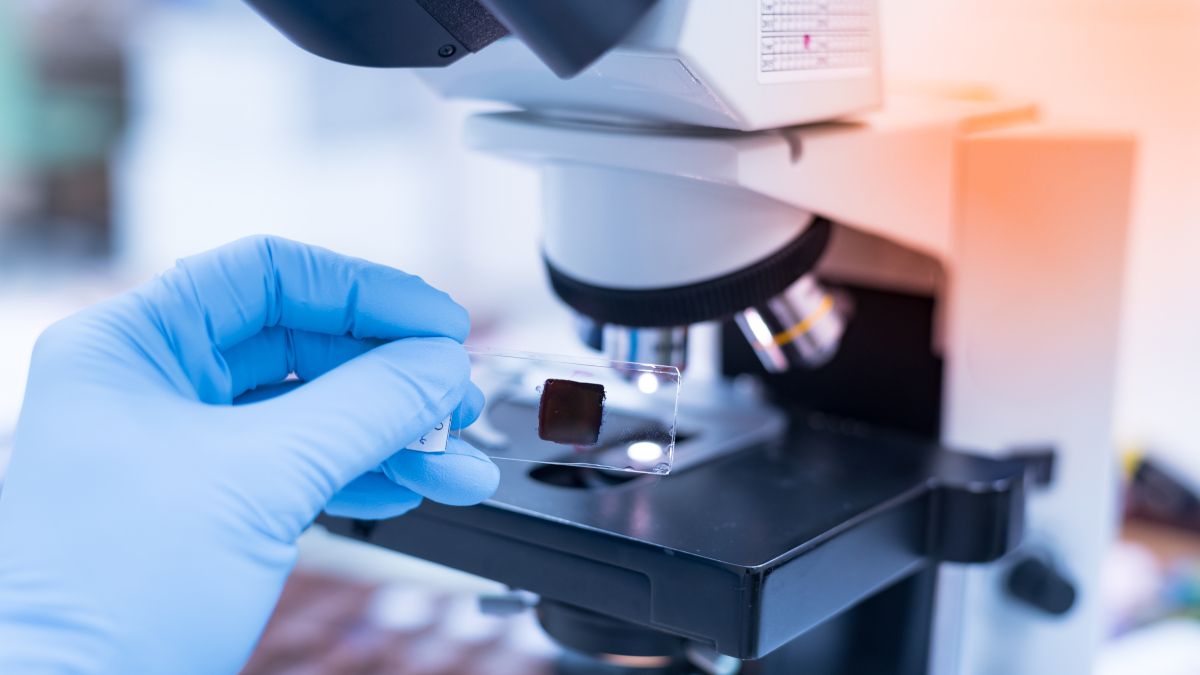 Prospektywne badanie kliniczne fazy II prowadzone przez German Lymphoma Alliance