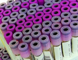 Przegląd systematyczny skuteczności i bezpieczeństwa G-CSF o długotrwałym działaniu...