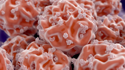 Przeszczepy szpiku od dawcy haploidentycznego z RIC zawierającym busulfan, skuteczną metodą leczenia nawrotowej i opornej postaci HL