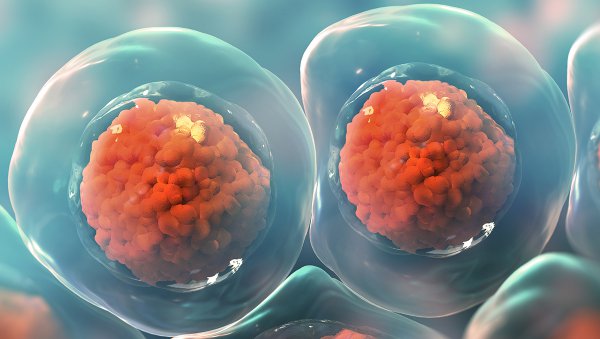 Przeszczepienie alogenicznych komórek krwiotwórczych u pacjentów z MDS i del(5q)