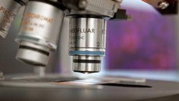 Przeżycie chorych na MCL po leczeniu ibrutynibem