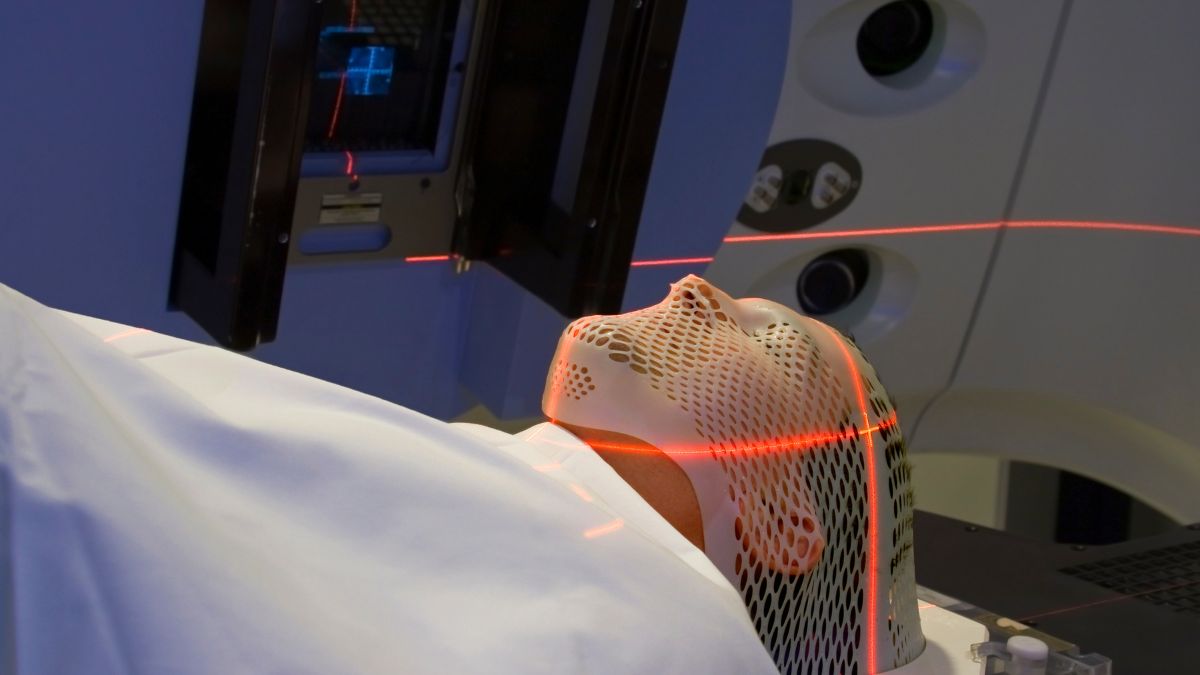 Skóra a radioterapia