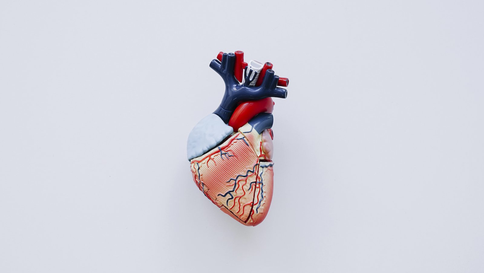 Analiza „real-life” danych klinicznych i przeżycia chorych na amyloidozę łańcuchów lekkich z zajęciem serca