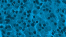 Relacja cyfrowa z warsztatów szpiczakowych w Ostrawie dostępna