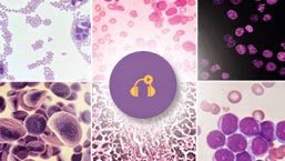 Relacja cyfrowa z Konferencji „Nowotwory hematologiczne wysokiego ryzyka” już dostępna