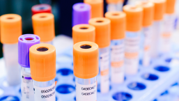 Różny wpływ produktów czynnika VIII na rozwój inhibitora