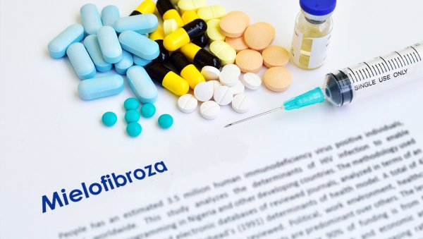 Ruksolitynib w leczeniu pierwotnej mielofibrozy w fazie akceleracji i z małopłytkowością – opis przypadku