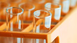 Rytuksymab i bendamustyna oraz rytuksymab i cytarabina przed przeszczepieniem chorych na MCL – wyniki badania klinicznego II fazy