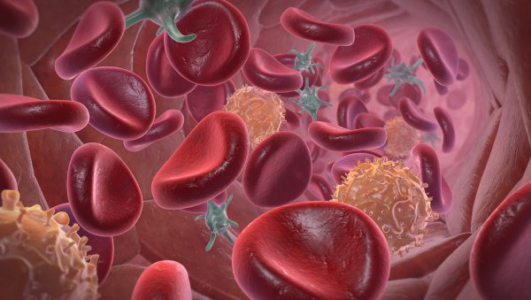 Ryzyko nawrotu NHL do OUN po terapii EPOCH-R