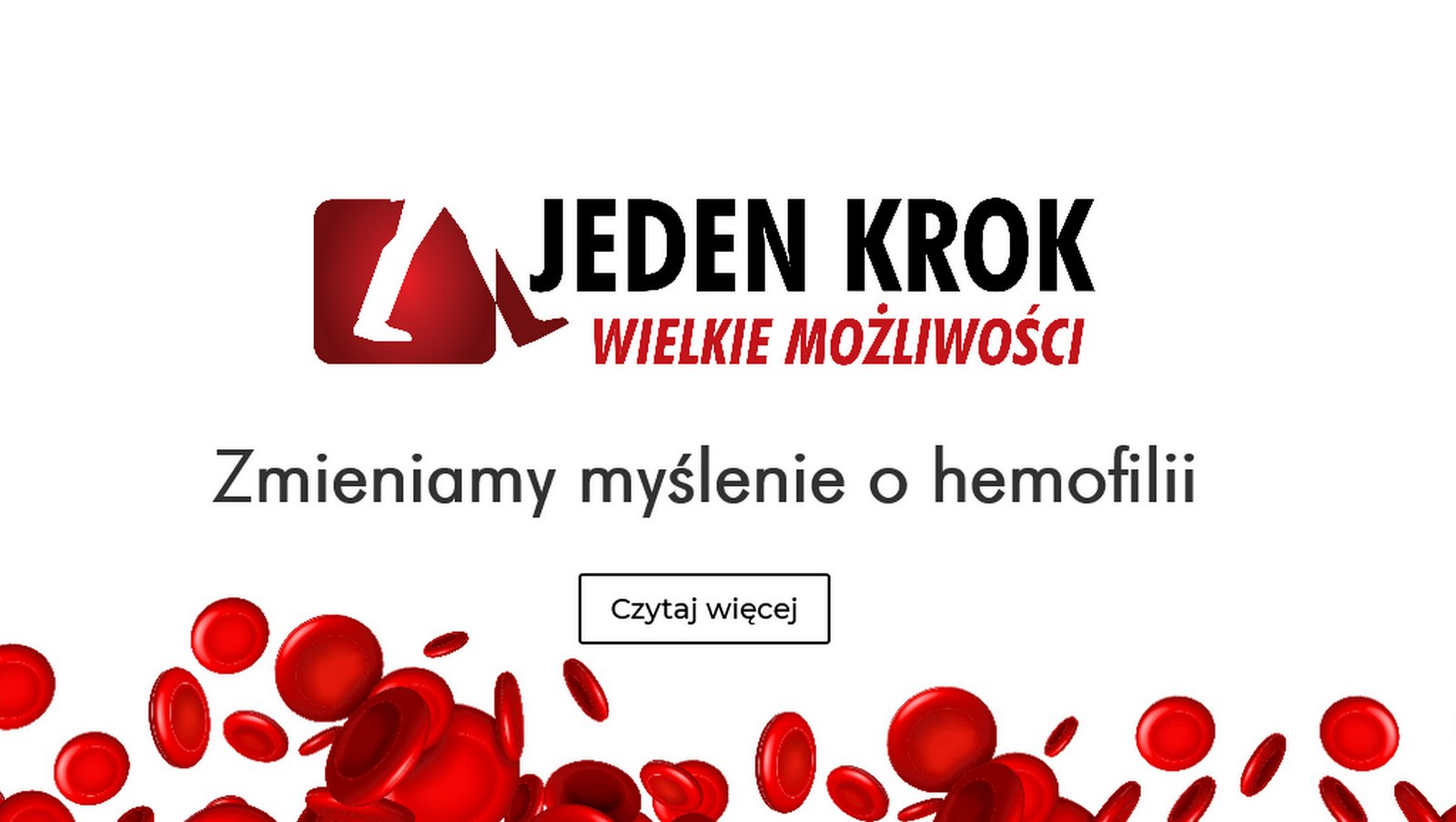 Hemofilia – częsta skaza krwotoczna wśród chorób rzadkich