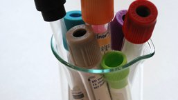 Sekwencyjne leczenie PBL inhibitorami kinaz w praktyce klinicznej
