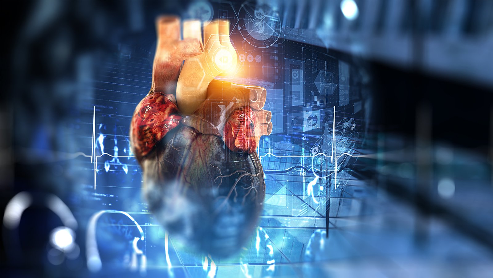 Zwiększona śmiertelność szpitalna wśród chorych hospitalizowanych z powodu migotania lub trzepotania przedsionków ze współistniejącą amyloidozą