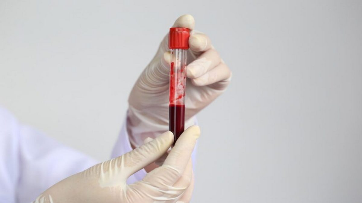 Polska hematologia wymaga usprawnień