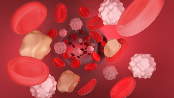 Skuteczność i bezpieczeństwo karfilzomibu a autoHSCT w nawrotowym/opornym szpiczaku...