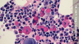 Spotkanie Polskiej Grupy Szpiczakowej | 24.10.2015