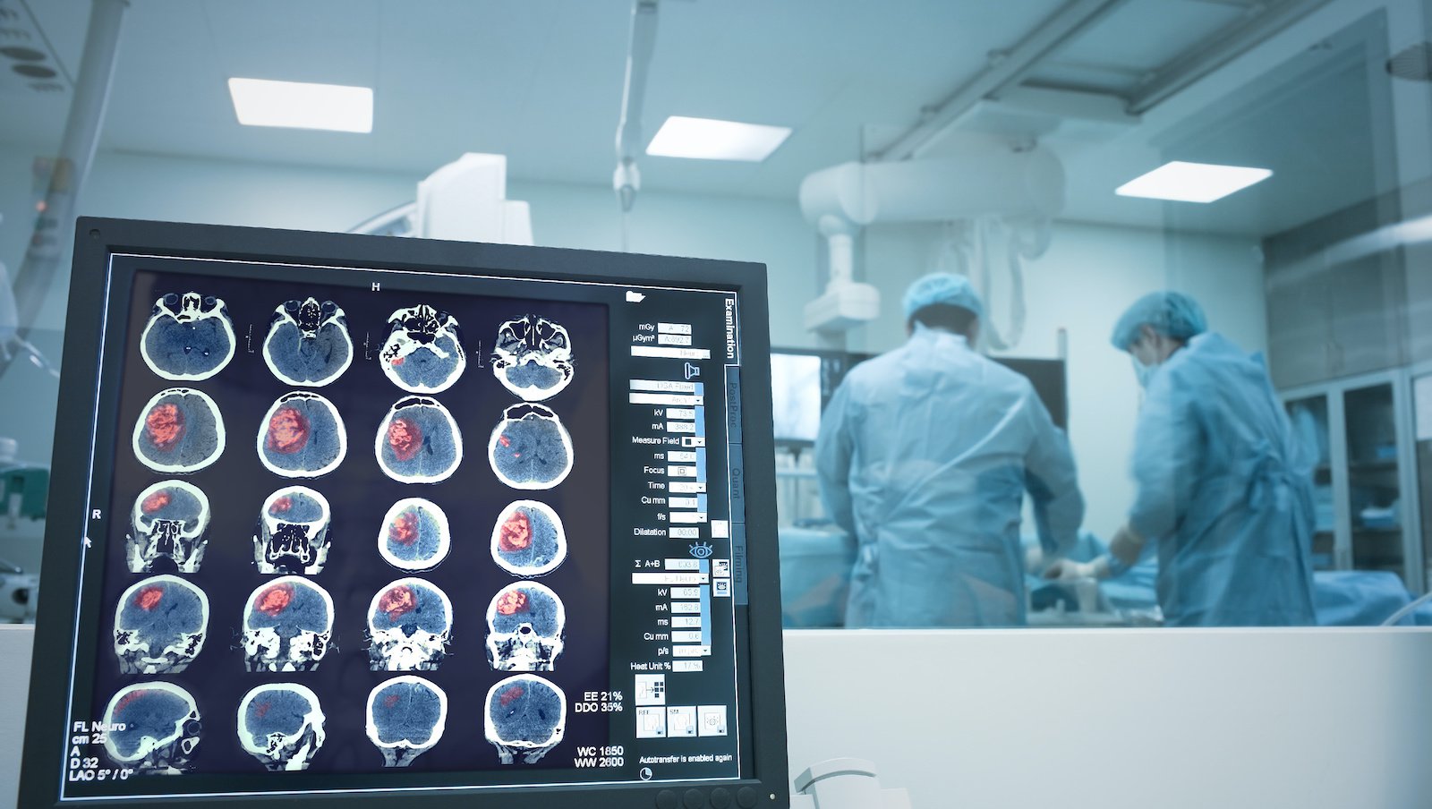 Z gabinetu hematologa – młody dorosły z udarem niedokrwiennym nieznanego pochodzenia