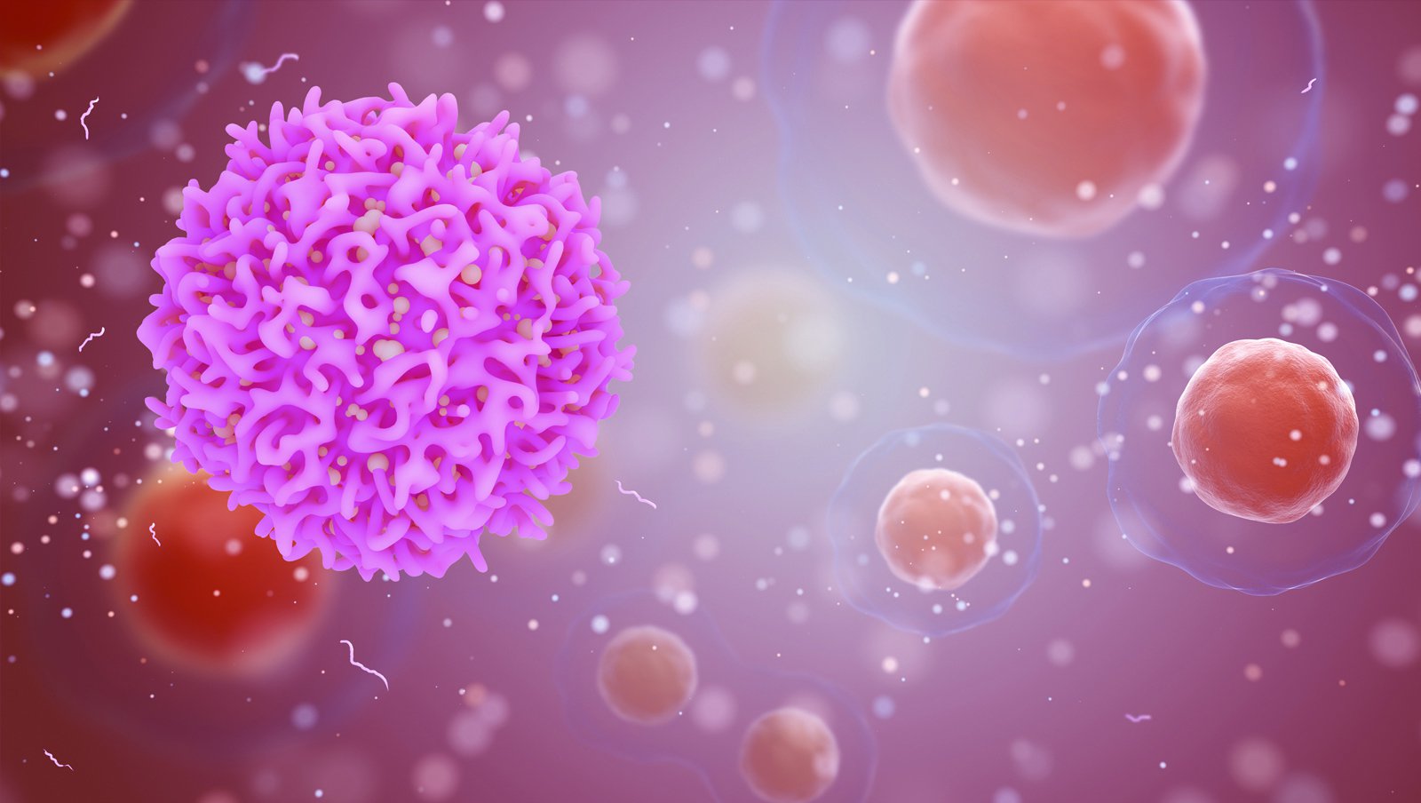 Rzadkie postacie chłoniaków T-komórkowych – aktualne postępowanie