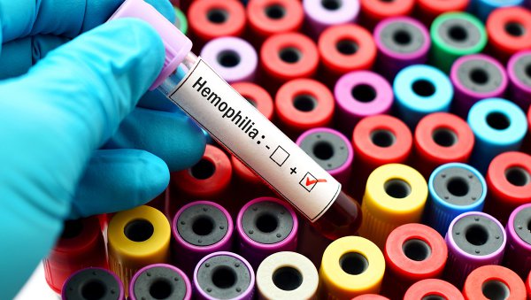 Terapia przeciwciałem bispecyficznym w hemofilii