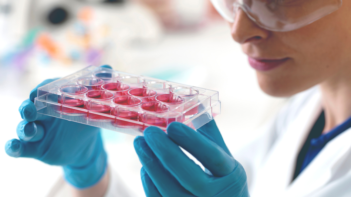 Potransplantacyjny cyklofosfamid versus globulina antytymocytarna po przeszczepieniu alogenicznych komórek krwiotwórczych z krwi obwodowej u biorców od zgodnych dawców rodzinnych i zgodnych 10/10 dawców niespokrewnionych: końcowa analiza randomizowanego, wieloośrodkowego otwartego badania 2 fazy