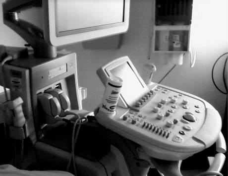 Znaczenie technik obrazowych w nowoczesnym leczeniu szpiczaka plazmocytowego