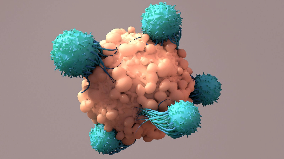 Immunoterapia z wykorzystaniem komórek NK – kolejna granica leczenia nowotworów