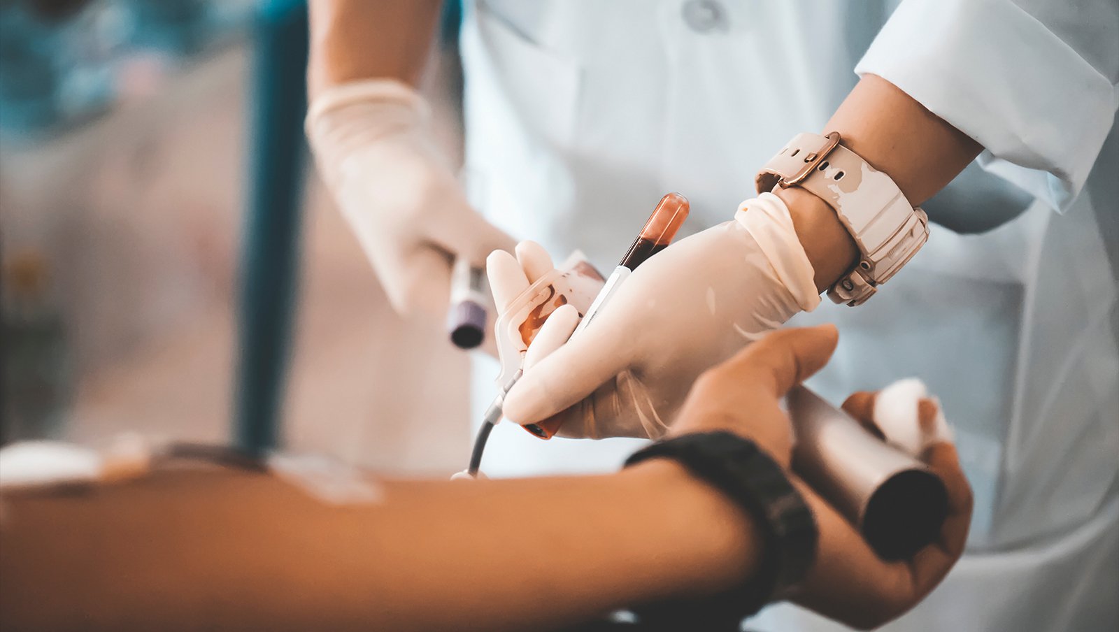 HAPLO-HCT jako opcja leczenia pacjentów z nawracającą lub oporną na leczenie ciężką niedokrwistością aplastyczną