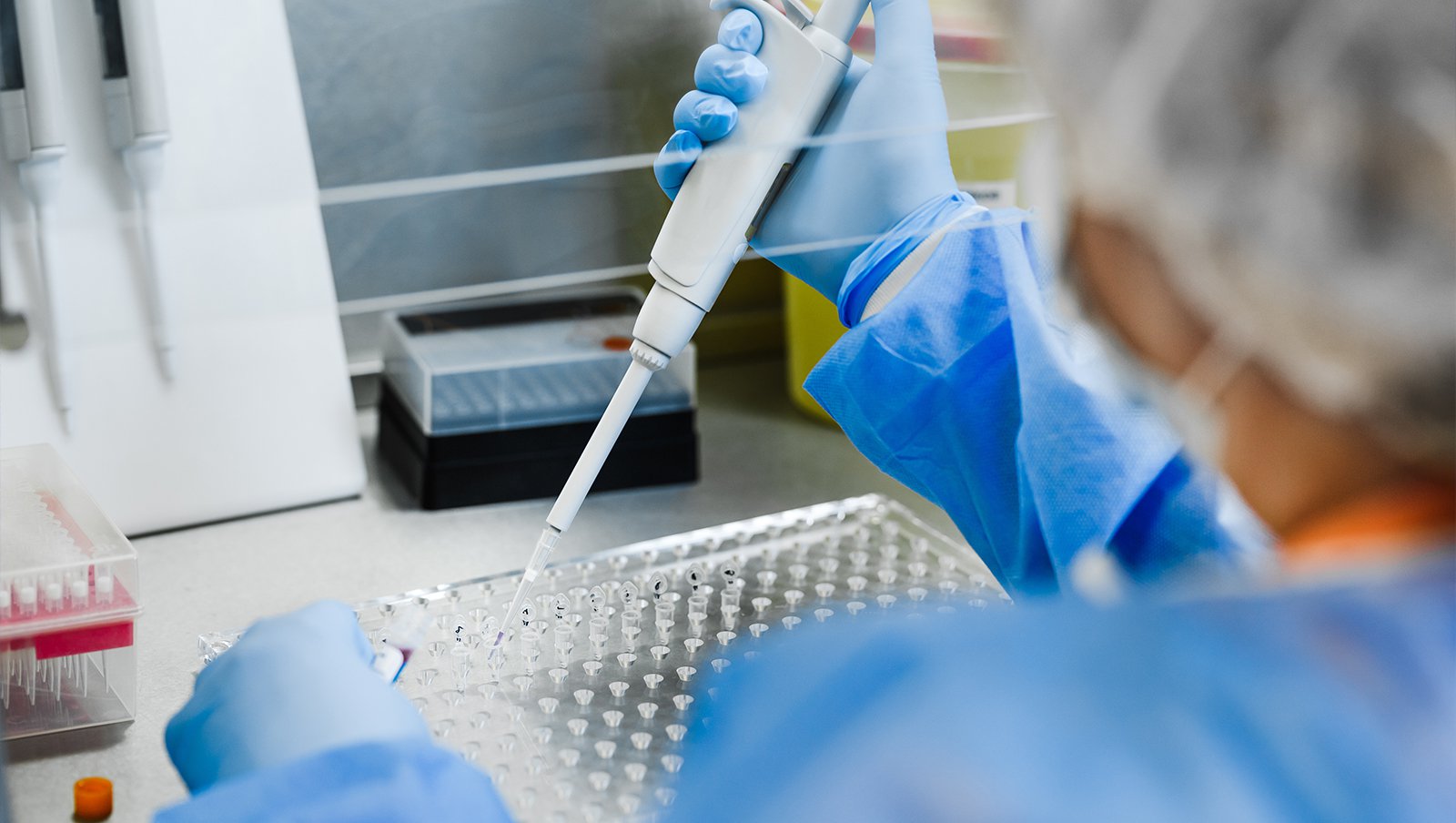 GPRC5D – kolejna terapia CAR-T w krajobrazie leczniczym szpiczaka plazmocytowego