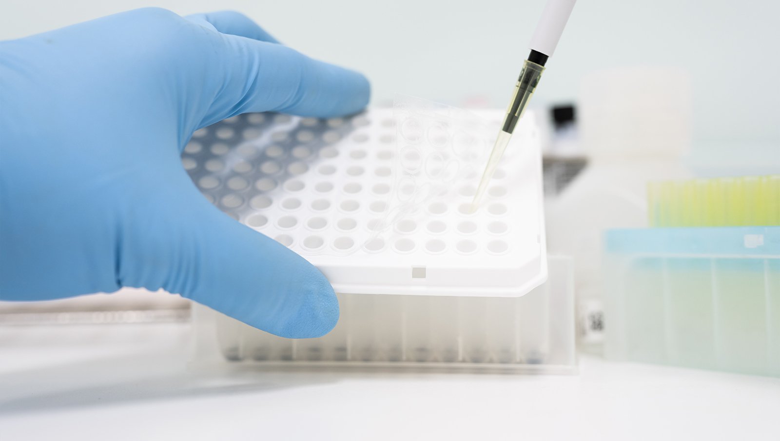 Skuteczność i bezpieczeństwo nowego niemieloablacyjnego schematu kondycjonowania po przeszczepieniu komórek krwiotwórczych u dorosłych z ciężką niedokrwistością aplastyczną