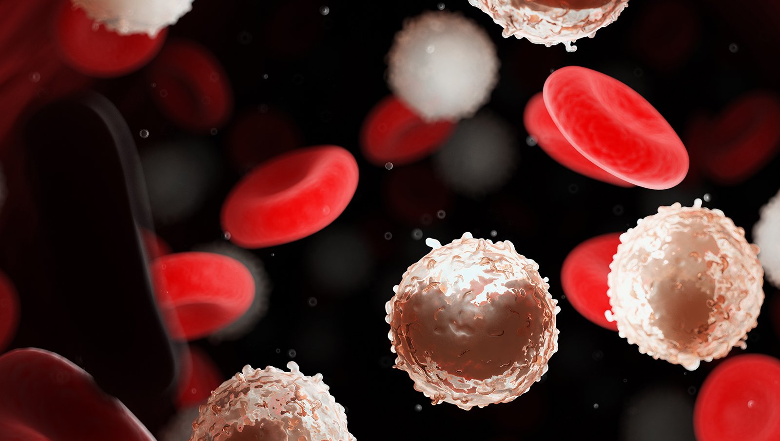 Skojarzenie ibrutynibu i wenetoklaksu w leczeniu pierwszej linii pacjentów z przewlekłą...