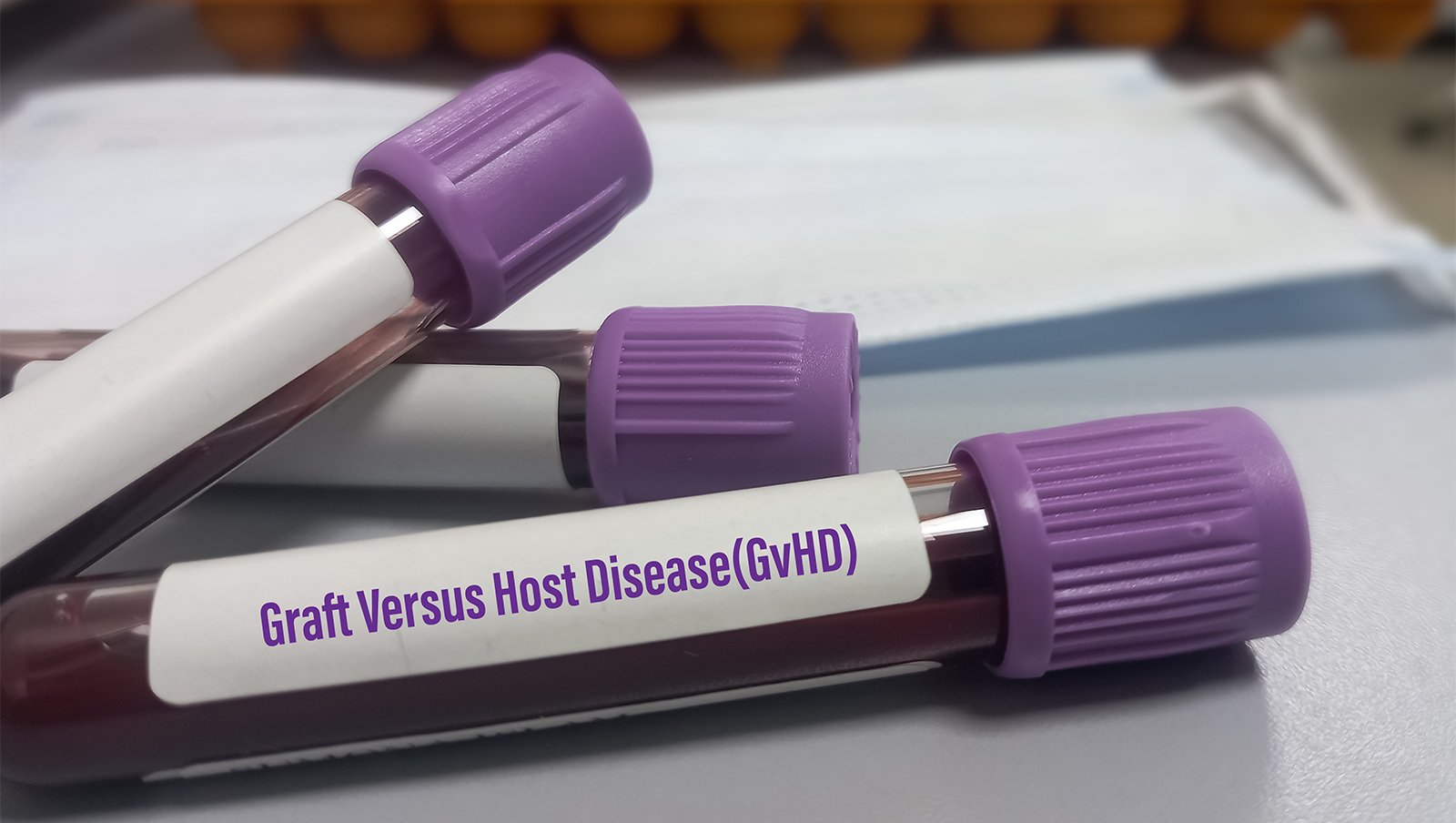 Faza II badania klinicznego oceniająca abatacept u pacjentów ze sterydo-oporną przewlekłą chorobą przeszczep-przeciwko-gospodarzowi