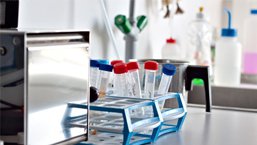 Wpływ hormonalnej terapii zastępczej na płytki krwi oraz mikrocząstki płytkowe