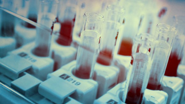 Wpływ profilaktyki przeciwinfekcyjnej na śmiertelność i ryzyko wystąpienia infekcji u chorych na zespoły mielodysplastyczne i ostrą białaczkę szpikową leczonych azacytydyną