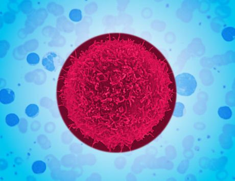 Odległe wyniki autotransplantacji komórek krwiotwórczych w zespole POEMS na podstawie...