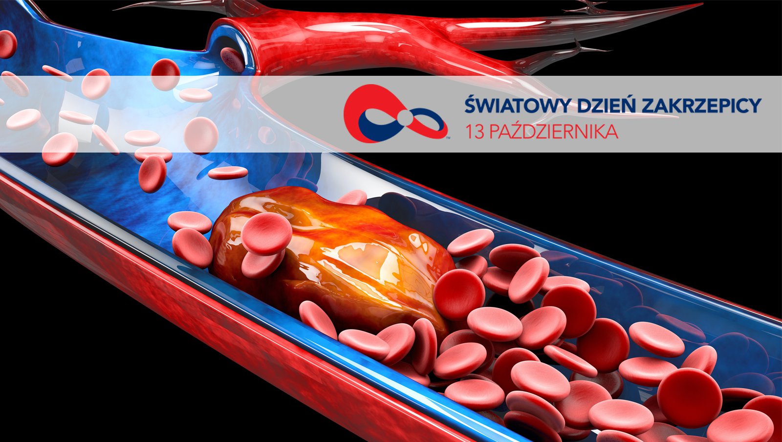 13 października | Światowy Dzień Zakrzepicy