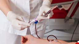 Zastosowanie surowicy antytymocytarnej w kondycjonowaniu niemieloablacyjnym poprawia przeżycie wolne od choroby i zmniejsza ryzyko rozwoju choroby przeszczep przeciwko gospodarzowi