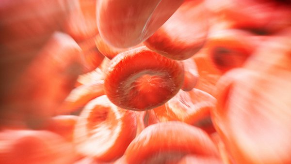 Zastosowanie globuliny antytymocytarnej może poprawiać rokowanie w allogenicznych przeszczepach komórek szpiku kostnego od dawców niespokrewnionych w leczeniu MDS