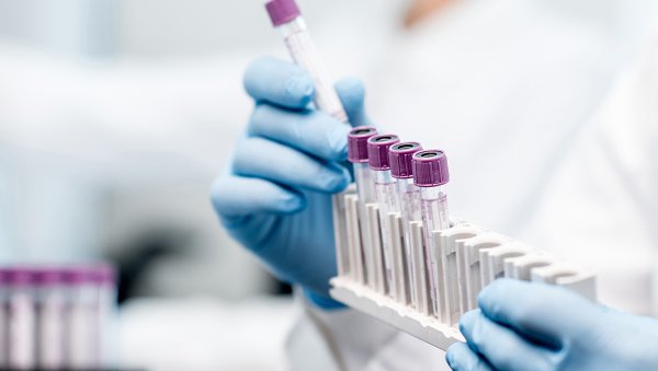 Znaczenie badań molekularnych dla oceny ryzyka i rokowania u chorych na pierwotne włóknienie szpiku w oparciu o wskaźniki prognostyczne IPSS, DIPSS oraz MIPSS