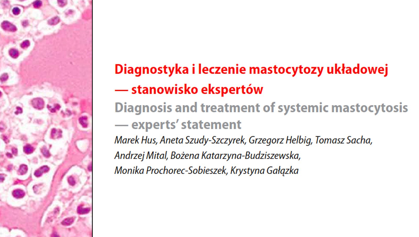 Diagnostyka i leczenie mastocytozy układowej — stanowisko ekspertów