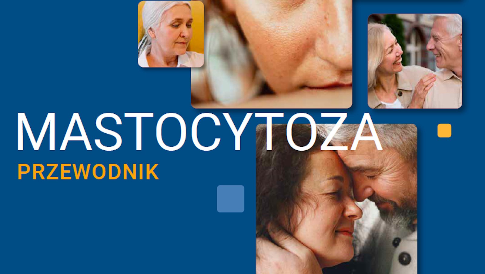 Mastocytoza | Przewodnik dla Chorych