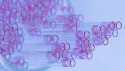 Związek między płcią a nasileniem i rodzajem objawów u chorych na mieloproliferacje