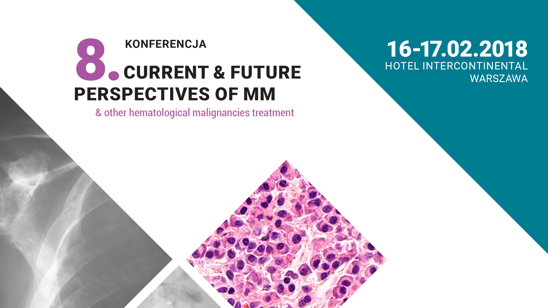 8. Konferencja CURRENT & FUTURE  PERSPECTIVES OF MM & other hematological malignancies...