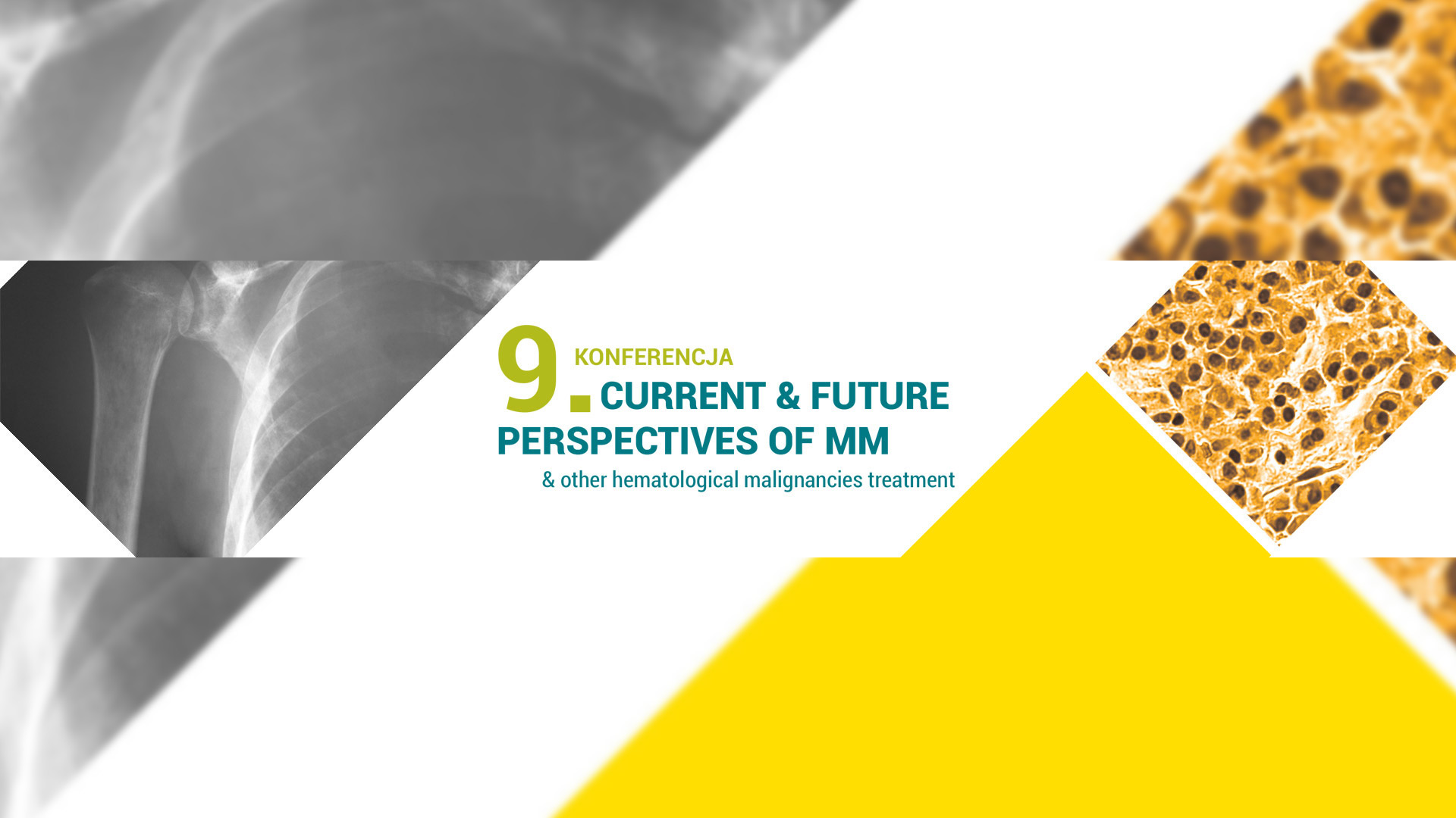 9th CURRENT & FUTURE PERSPECTIVES OF MM & other hematological malignancies treatment...