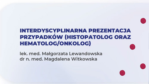 Klasyczny Chłoniak Hodgkina